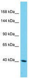 Sterile alpha motif domain-containing protein 9-like antibody, TA333477, Origene, Western Blot image 