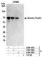 Taxilin Gamma antibody, A304-041A, Bethyl Labs, Immunoprecipitation image 