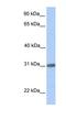 Chromosome 7 Open Reading Frame 61 antibody, NBP1-56948, Novus Biologicals, Western Blot image 