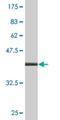 DOT1 Like Histone Lysine Methyltransferase antibody, H00084444-M02, Novus Biologicals, Western Blot image 