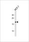 Ras antibody, MBS9213867, MyBioSource, Western Blot image 