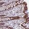 Isocitrate Dehydrogenase (NAD(+)) 3 Alpha antibody, NBP1-85840, Novus Biologicals, Immunohistochemistry frozen image 