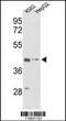 Actin Gamma 1 antibody, MBS9215295, MyBioSource, Western Blot image 