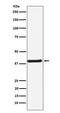 Calcium/Calmodulin Dependent Protein Kinase I antibody, M02576, Boster Biological Technology, Western Blot image 