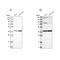 Mitochondrial Trans-2-Enoyl-CoA Reductase antibody, NBP1-85657, Novus Biologicals, Western Blot image 