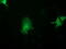 Activating Signal Cointegrator 1 Complex Subunit 2 antibody, M12860, Boster Biological Technology, Immunofluorescence image 