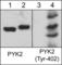 Protein Tyrosine Kinase 2 Beta antibody, PM2691, ECM Biosciences, Western Blot image 