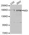 Nidogen 1 antibody, A8349, ABclonal Technology, Western Blot image 