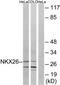 NK2 Homeobox 6 antibody, TA316114, Origene, Western Blot image 