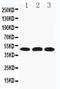 Hyaluronidase 3 antibody, PA5-79422, Invitrogen Antibodies, Western Blot image 