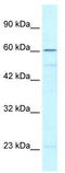 Zinc Finger Protein 212 antibody, TA333882, Origene, Western Blot image 