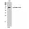 Signal Transducing Adaptor Molecule 2 antibody, LS-C380999, Lifespan Biosciences, Western Blot image 