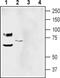 Acid Sensing Ion Channel Subunit 1 antibody, PA5-77740, Invitrogen Antibodies, Western Blot image 