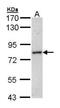 Myotubularin Related Protein 14 antibody, NBP1-32416, Novus Biologicals, Western Blot image 