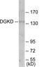 Diacylglycerol Kinase Delta antibody, EKC1839, Boster Biological Technology, Western Blot image 