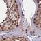 RNA Polymerase II Subunit C antibody, NBP1-80818, Novus Biologicals, Immunohistochemistry paraffin image 