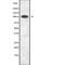 OPA1 Mitochondrial Dynamin Like GTPase antibody, abx217501, Abbexa, Western Blot image 