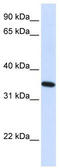Reticulon 1 antibody, TA338453, Origene, Western Blot image 