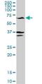 Glutamic--Pyruvic Transaminase antibody, H00002875-D01P, Novus Biologicals, Western Blot image 