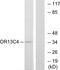 Olfactory Receptor Family 13 Subfamily C Member 4 antibody, PA5-38164, Invitrogen Antibodies, Western Blot image 