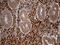 Chitinase Acidic antibody, M00437, Boster Biological Technology, Immunohistochemistry paraffin image 