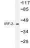 Interferon Regulatory Factor 2 antibody, AP06668PU-N, Origene, Western Blot image 