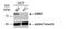 G Protein-Coupled Receptor Kinase 2 antibody, NBP1-31978, Novus Biologicals, Western Blot image 
