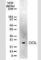 C-Type Lectin Domain Family 2 Member D antibody, NB100-56553, Novus Biologicals, Western Blot image 