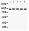 Villin 1 antibody, PA5-80221, Invitrogen Antibodies, Western Blot image 