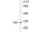 Cannabinoid Receptor 2 antibody, LS-C177098, Lifespan Biosciences, Western Blot image 