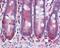 Matrix Metallopeptidase 11 antibody, 49-774, ProSci, Immunohistochemistry frozen image 