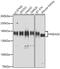 Histone Deacetylase 6 antibody, GTX02885, GeneTex, Western Blot image 
