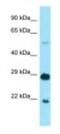 IKAROS Family Zinc Finger 1 antibody, NBP1-98565, Novus Biologicals, Western Blot image 