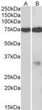 NIMA Related Kinase 7 antibody, 42-701, ProSci, Enzyme Linked Immunosorbent Assay image 