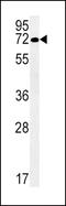 Solute Carrier Family 19 Member 3 antibody, LS-C161149, Lifespan Biosciences, Western Blot image 