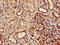 Dolichol-phosphate mannosyltransferase antibody, CSB-PA007134LA01HU, Cusabio, Immunohistochemistry paraffin image 