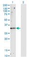 TIMP Metallopeptidase Inhibitor 1 antibody, LS-C198343, Lifespan Biosciences, Western Blot image 