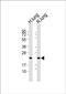 Surfactant Protein C antibody, PA5-71680, Invitrogen Antibodies, Western Blot image 