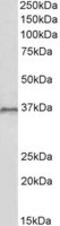 Homeobox C10 antibody, MBS423312, MyBioSource, Western Blot image 