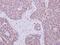 Insulin Receptor Substrate 1 antibody, GTX113213, GeneTex, Immunohistochemistry paraffin image 