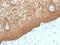 Keratin 14 antibody, M01432, Boster Biological Technology, Immunohistochemistry paraffin image 