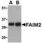 Fas Apoptotic Inhibitory Molecule 2 antibody, PA5-20311, Invitrogen Antibodies, Western Blot image 