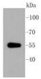 Aldehyde Dehydrogenase 1 Family Member A1 antibody, NBP2-67385, Novus Biologicals, Western Blot image 