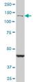 DEAH-Box Helicase 8 antibody, H00001659-M07, Novus Biologicals, Western Blot image 