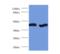 Glutamic-Oxaloacetic Transaminase 2 antibody, MBS7006066, MyBioSource, Western Blot image 