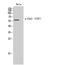 Checkpoint Kinase 2 antibody, A00277T387-1, Boster Biological Technology, Western Blot image 