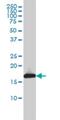 Ubiquitin-conjugating enzyme E2 L3 antibody, H00007332-M01, Novus Biologicals, Western Blot image 