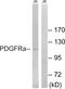 Platelet Derived Growth Factor Receptor Alpha antibody, LS-C199422, Lifespan Biosciences, Western Blot image 