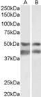 Alpha 2-HS Glycoprotein antibody, 43-416, ProSci, Western Blot image 