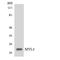 Myosin Light Chain 3 antibody, LS-B14684, Lifespan Biosciences, Western Blot image 